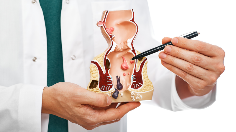 person in white lab coat pointing at model of rectum